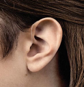 Hinter-dem-Ohr-Hörgeräte mit/ohne Akku 6