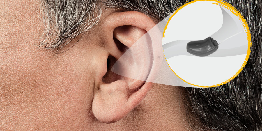 Im-Ohr-Hörgeräte 2